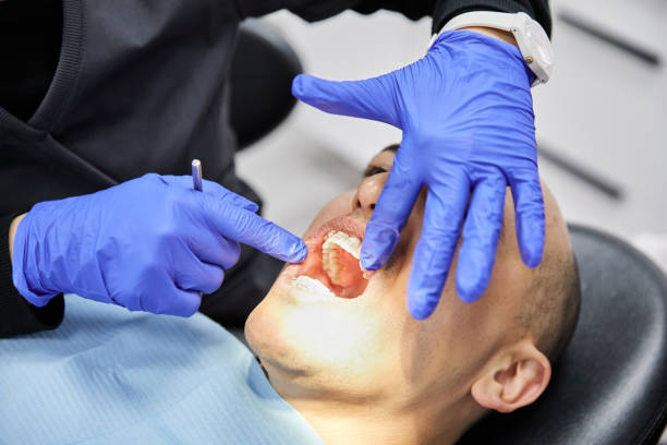 Best Emergency Denture Repair in Sarasota, FL